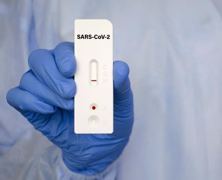 SINGAPOUR – CORONAVIRUS: Obligation d’un test PCR avant d’embarquer pour l’île État