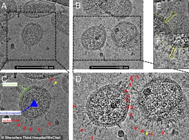 CHINE – CORONAVIRUS: Le COVID 19 photographié par des chercheurs chinois