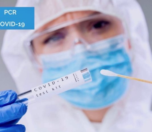 test PCR