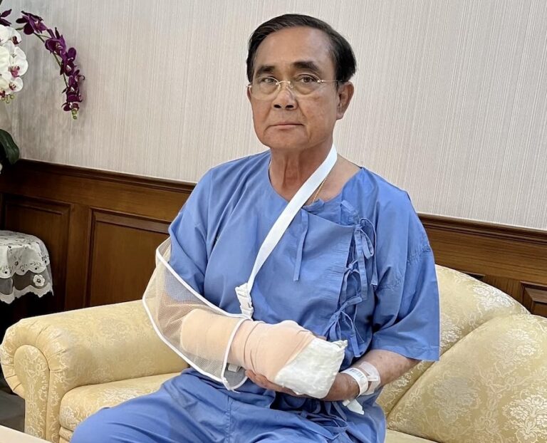 THAÏLANDE – POLITIQUE : Le Premier ministre thaïlandais Prayut récupère après une opération de la main